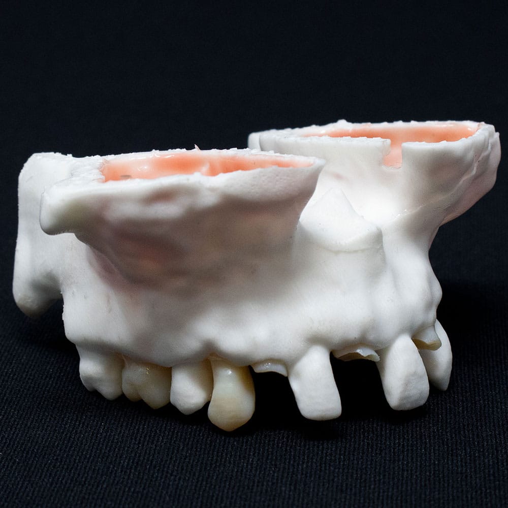 Anatomical Dental Models - BoneModels™